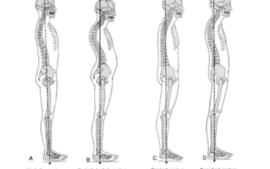 4 Steps to Improve your Posture