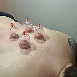 Jaimie Foden Soft Tissue Therapy Stourbridge